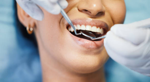 Best Emergency Dental Extractions in Campbell, MO